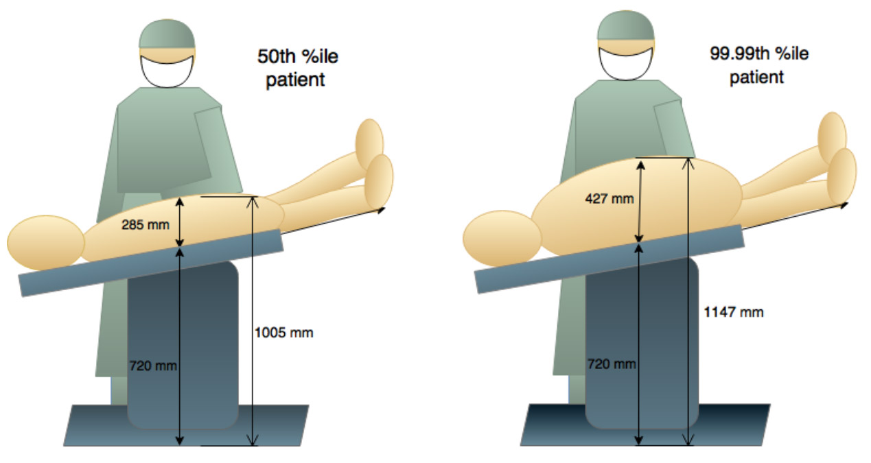 Surgeon Posture